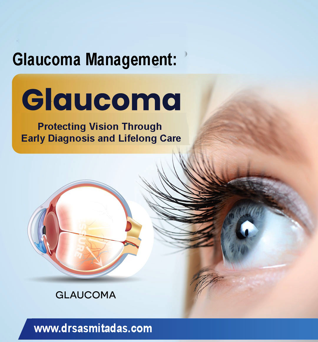 Glaucoma Management: Protecting Vision Through Early Diagnosis and Lifelong Care