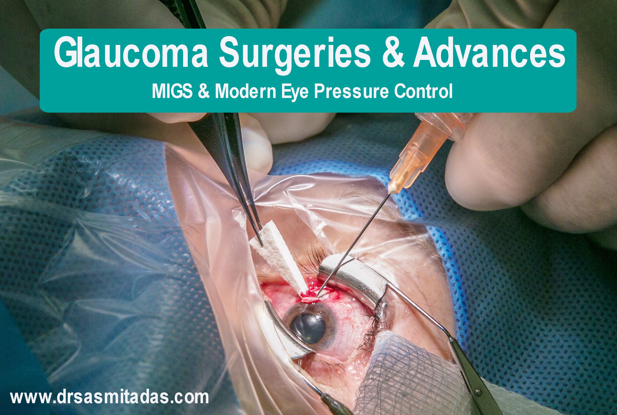 Glaucoma Surgeries and Newer Advances: A Modern Approach to Intraocular Pressure Control